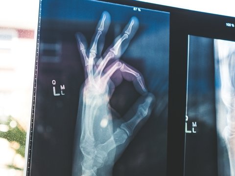 Во Франции не хватает врачей, и правительство запретило гражданам болеть